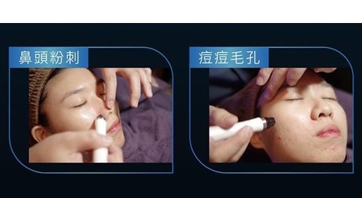 3D水旋負壓SPA (UltraSPA)