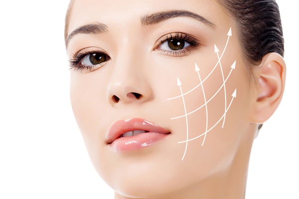 藍鑽魚骨線，高雄埋線拉提